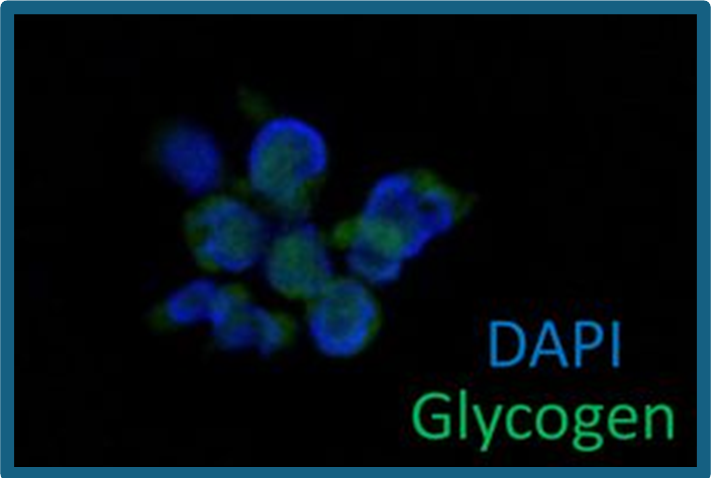 MAIT CELLS AND THE SCIENCE OF OBESITY